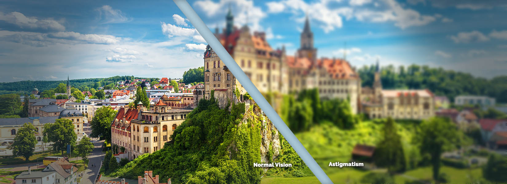 Astigmatism Treatment in Livonia