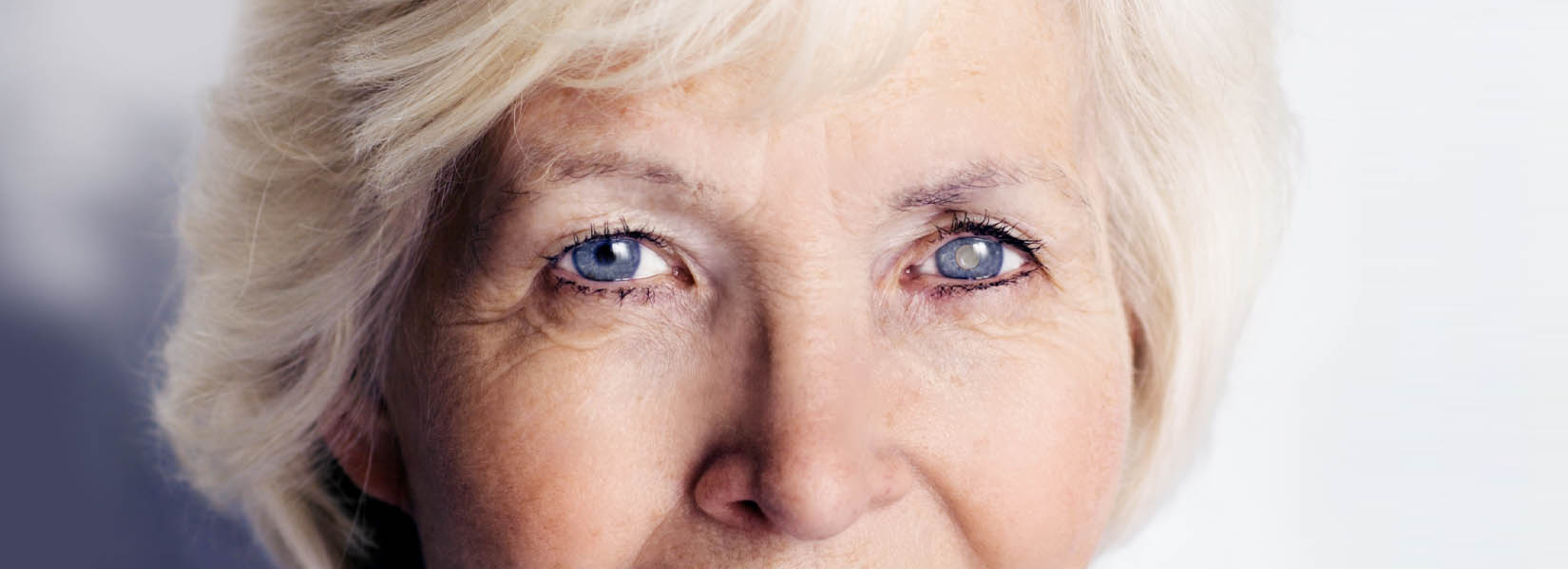 Cataract Surgery in Livonia