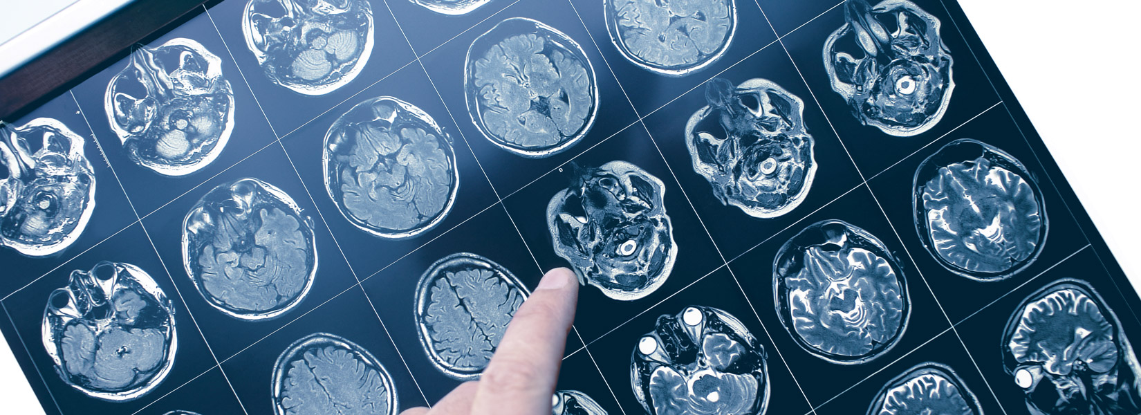 Neuro-Optometry in Livonia