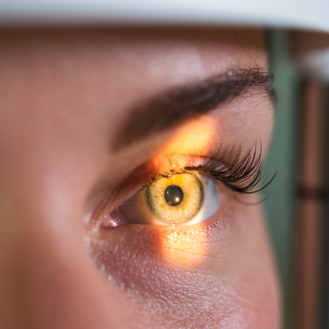 Vision Therapy in Livonia